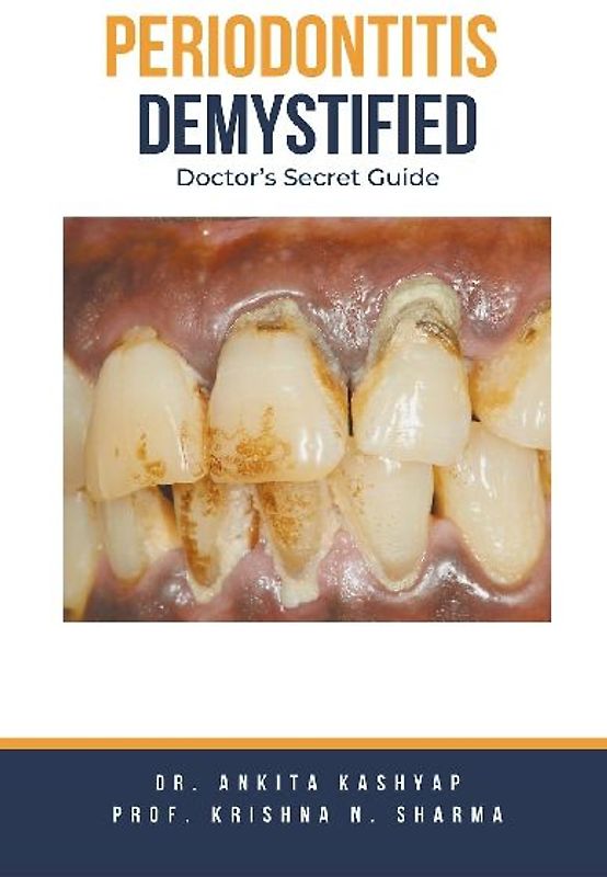 Periodontitis Demystified