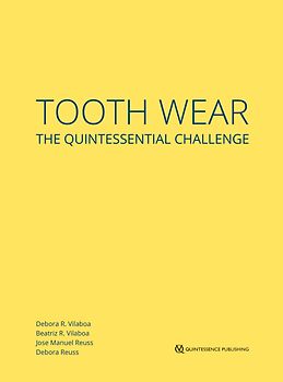 Desgaste Dental