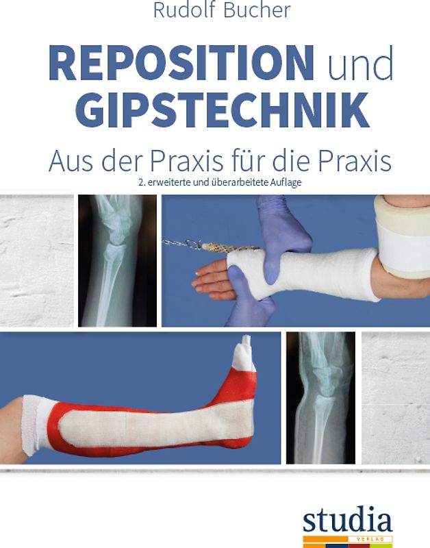 Reposition und Gipstechnik II