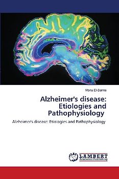 Alzheimer's disease: Etiologies and Pathophysiology