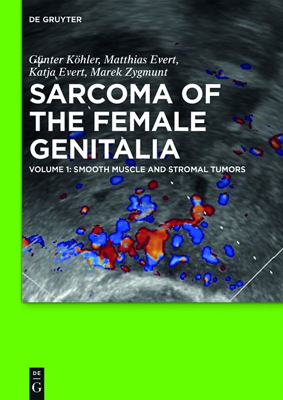 Sarcoma of the Female Genitalia / Smooth muscle and stromal tumors and prevention of inadequate surgery