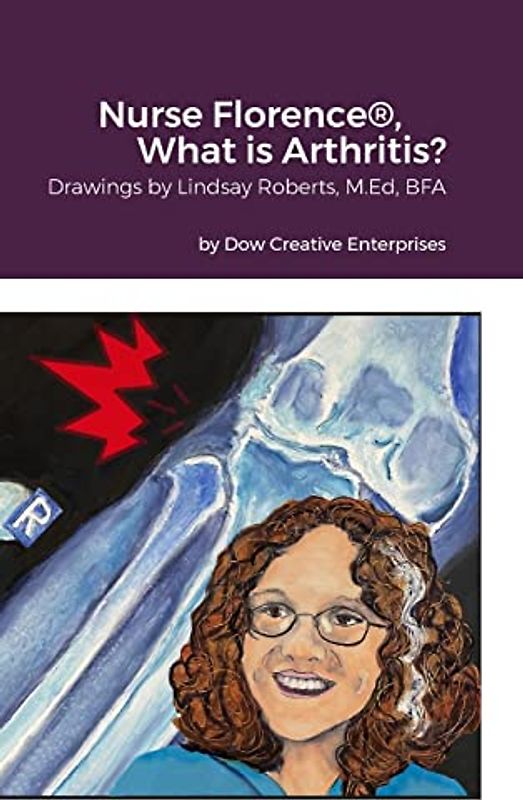 Nurse Florence®, What is Arthritis?