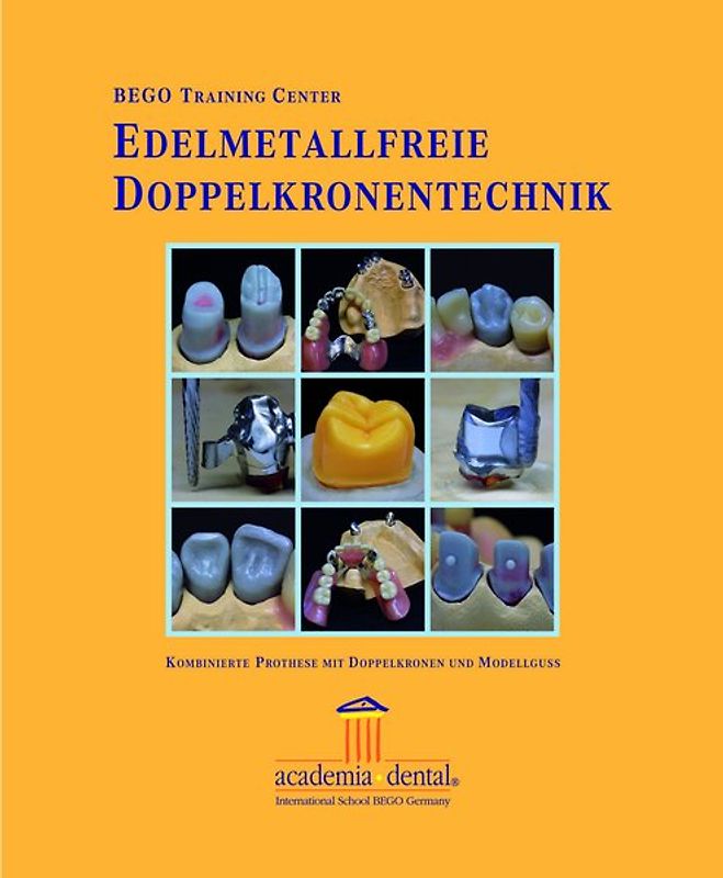Edelmetallfreie Doppelkronentechnik