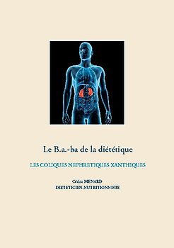 Le b.a-ba de la diététique pour les coliques néphrétiques xanthiques