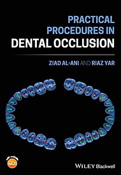 Practical Procedures in Dental Occlusion