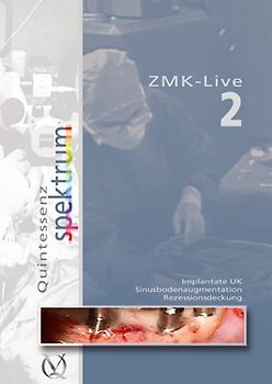 ZMK - Live 2. DVD. Implantate, Sinusbodenaugmentation, Rezessionsdeckung DVD