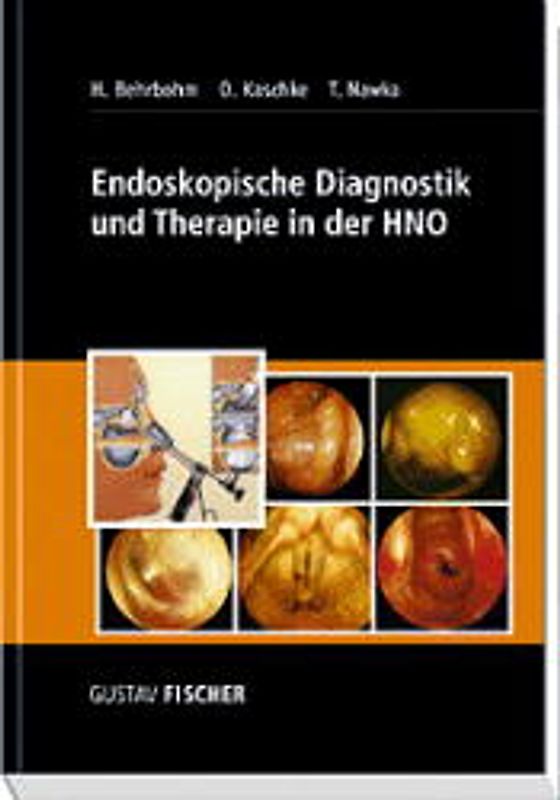 Endoskopische Diagnostik und Therapie in der HNO