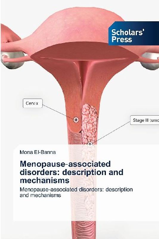 Menopause¿associated disorders: description and mechanisms