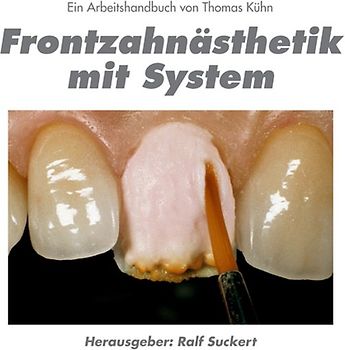Frontzahnästhetik mit System