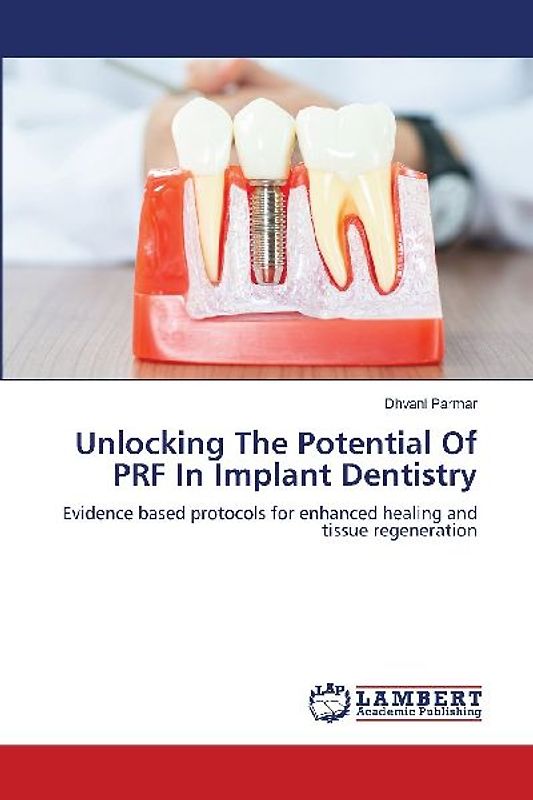 Unlocking The Potential Of PRF In Implant Dentistry