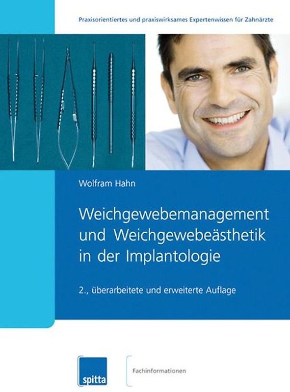 Weichgewebemanagement und Weichgewebeästhetik in der Implantologie