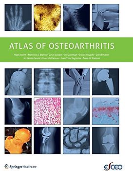 Atlas of Osteoarthritis
