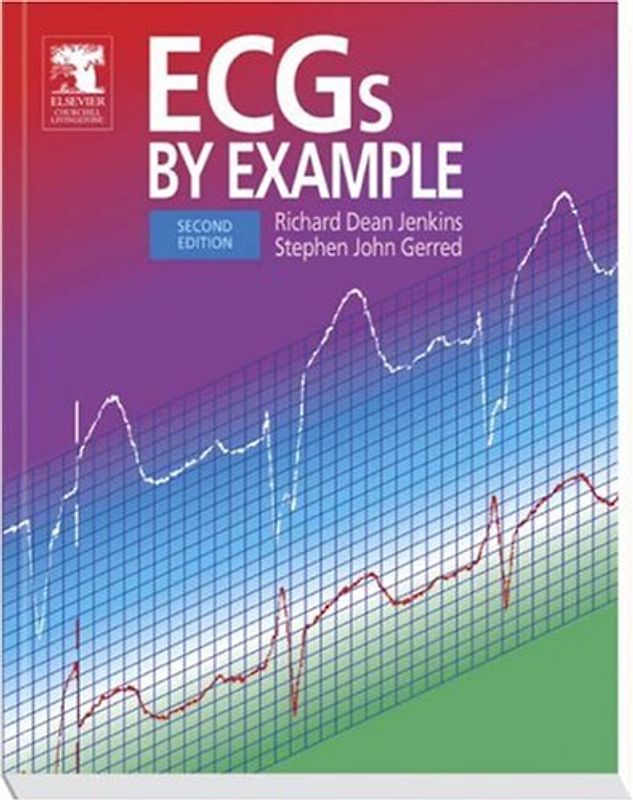 ECGs by Example