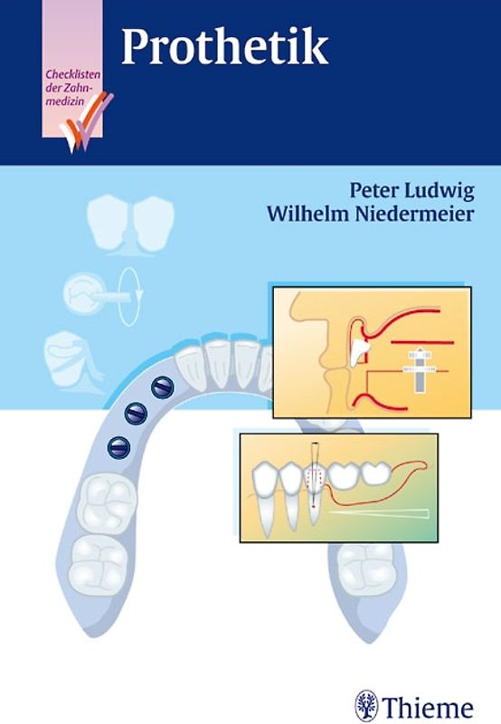 Checkliste Prothetik