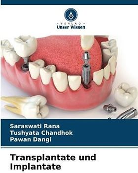 Transplantate und Implantate