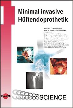 Minimal invasive Hüftendoprothetik