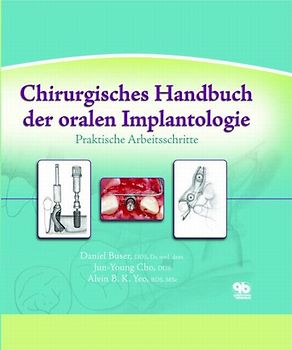 Chirurgisches Handbuch der oralen Implantologie