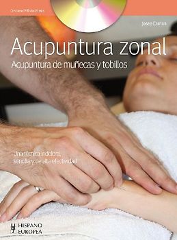 Acupuntura zonal
