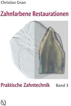 Zahnfarbene Restaurationen