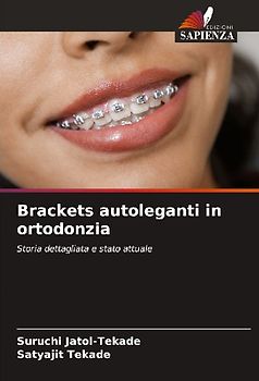 Brackets autoleganti in ortodonzia