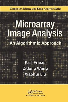 Microarray Image Analysis