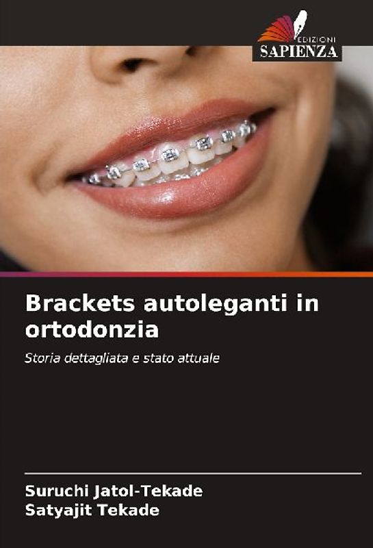 Brackets autoleganti in ortodonzia