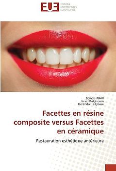 Facettes en résine composite versus Facettes en céramique