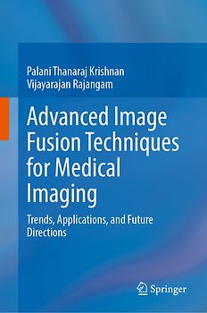 Advanced Image Fusion Techniques for Medical Imaging