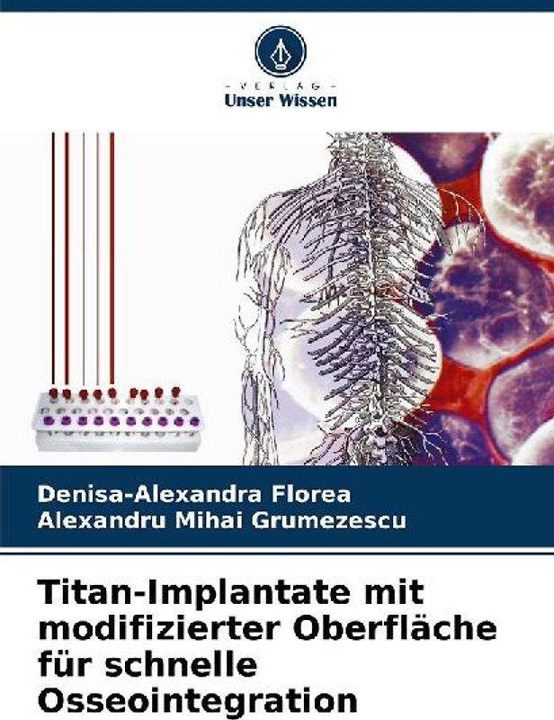 Titan-Implantate mit modifizierter Oberfläche für schnelle Osseointegration