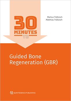 30 Minutes to Guided Bone Regeneration (GBR)