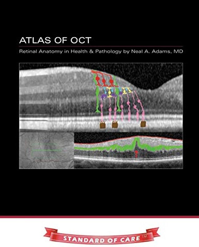 Atlas of OCT: Retinal Anatomy in Health & Pathology