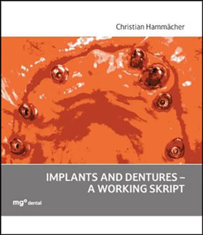 Implants and dentures - a working skript
