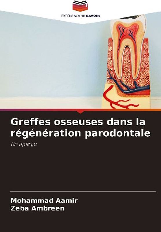 Greffes osseuses dans la régénération parodontale