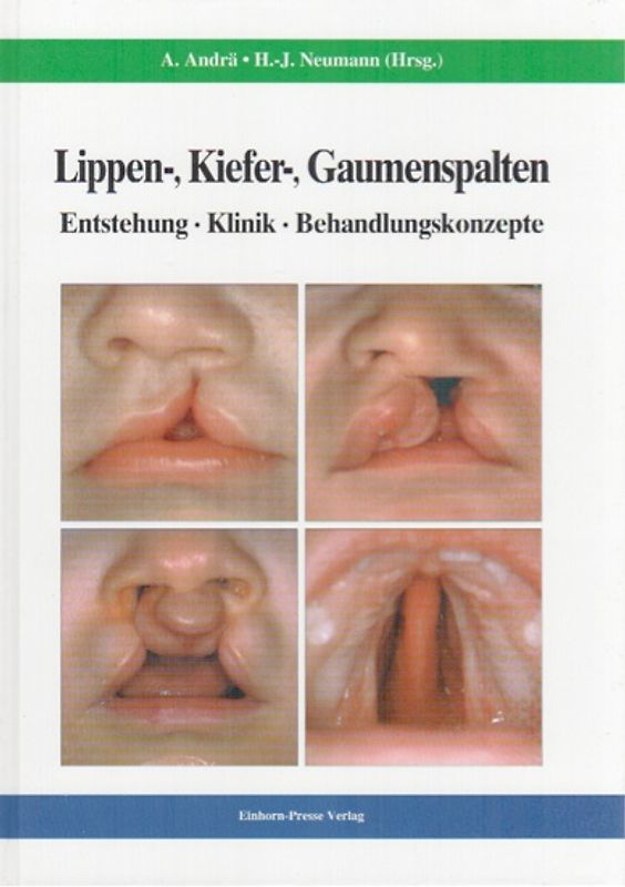 Lippen-, Kiefer-, Gaumenspalten