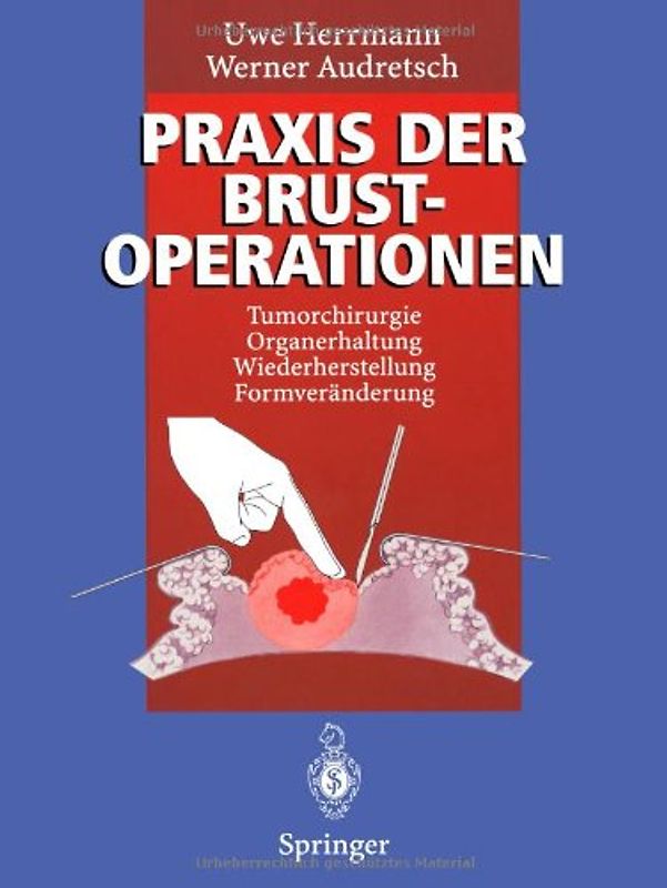 Praxis der Brustoperationen