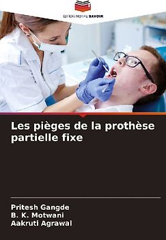 Les pièges de la prothèse partielle fixe