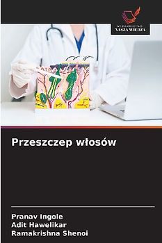 Przeszczep w¿osów