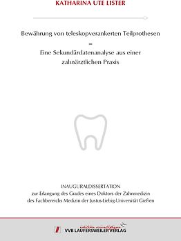 Bewährung von teleskopverankerten Teilprothesen