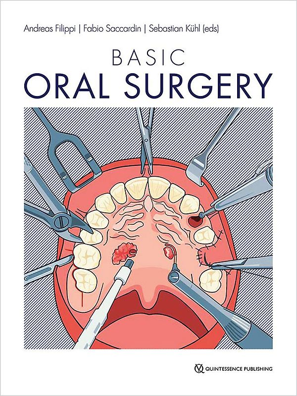 Basic Oral Surgery