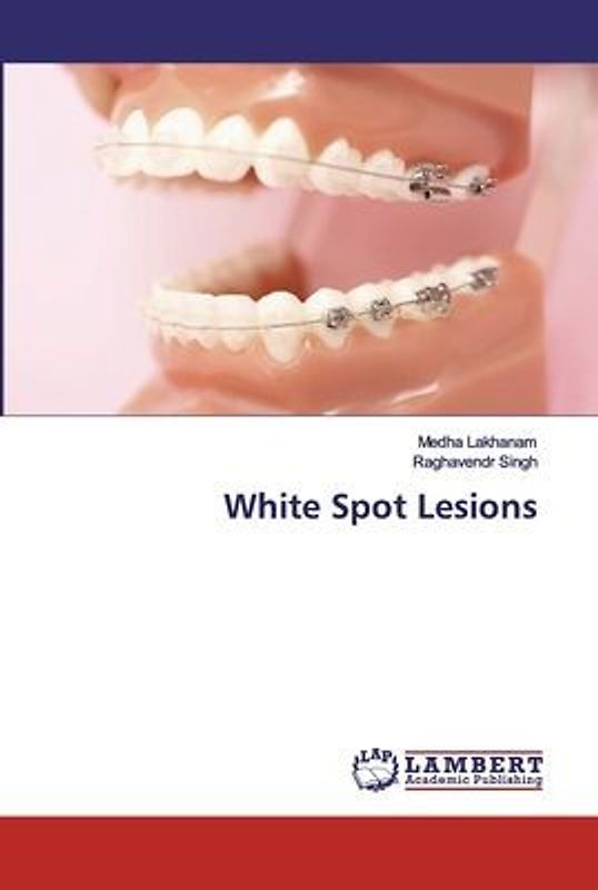 White Spot Lesions