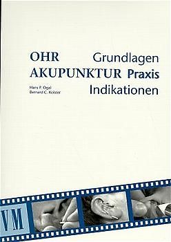Ohrakupunktur