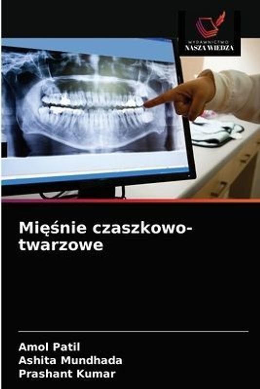 Mi¿¿nie czaszkowo-twarzowe