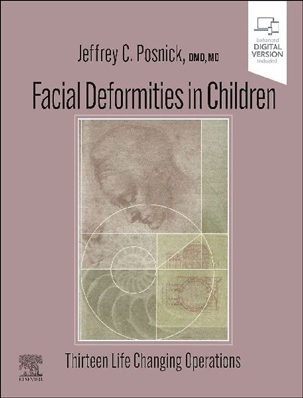Facial Deformities in Children
