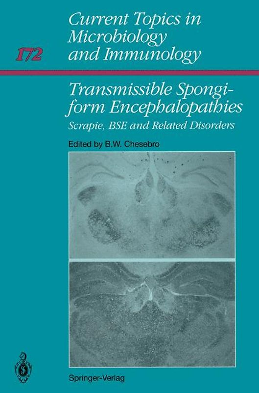 Transmissible Spongiform Encephalopathies: