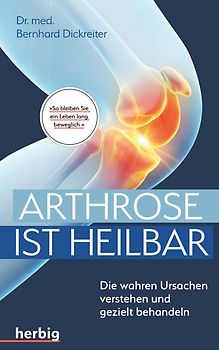 Arthrose ist heilbar