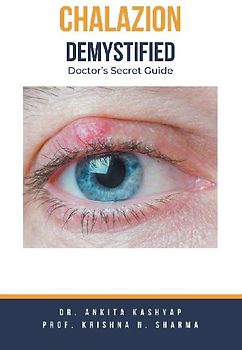 Chalazion Demystified