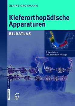 Kieferorthopädische Apparaturen