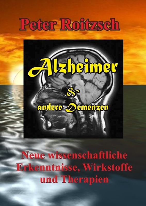 Alzheimer &amp; andere Demenzen