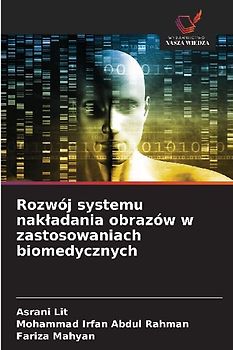 Rozwój systemu nak¿adania obrazów w zastosowaniach biomedycznych