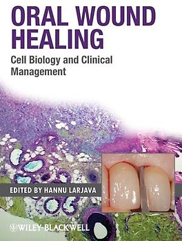 Oral Wound Healing
